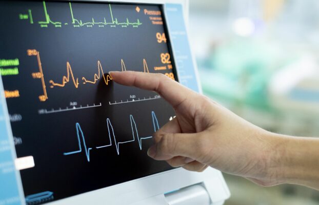 Che cos’è l’Elettrocardiogramma (ECG)? Un’Analisi Approfondita del Cuore