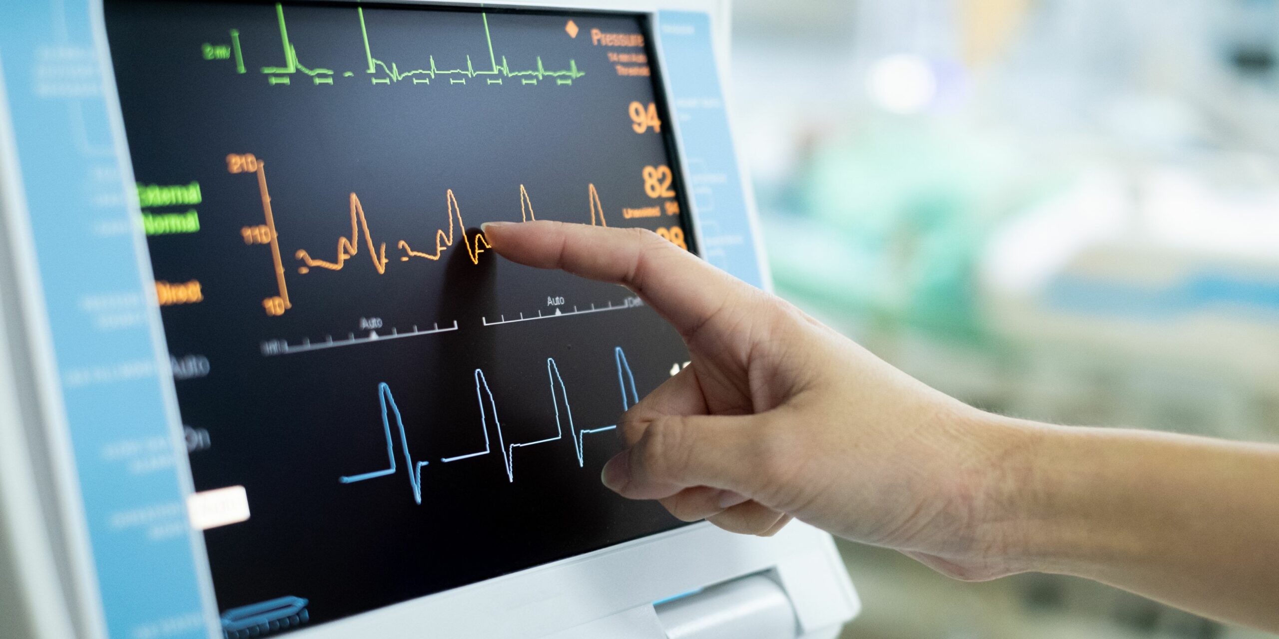 Che cos’è l’Elettrocardiogramma (ECG)? Un’Analisi Approfondita del Cuore